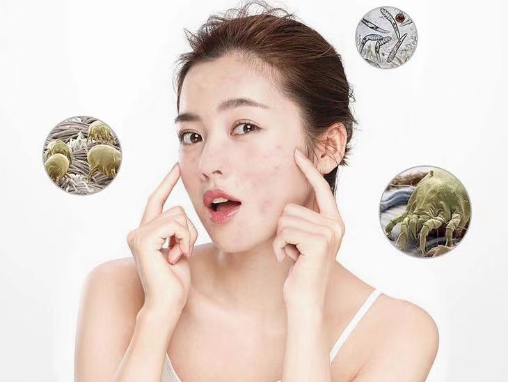 皮肤经常过敏，长痘？警惕是新房装修原因！