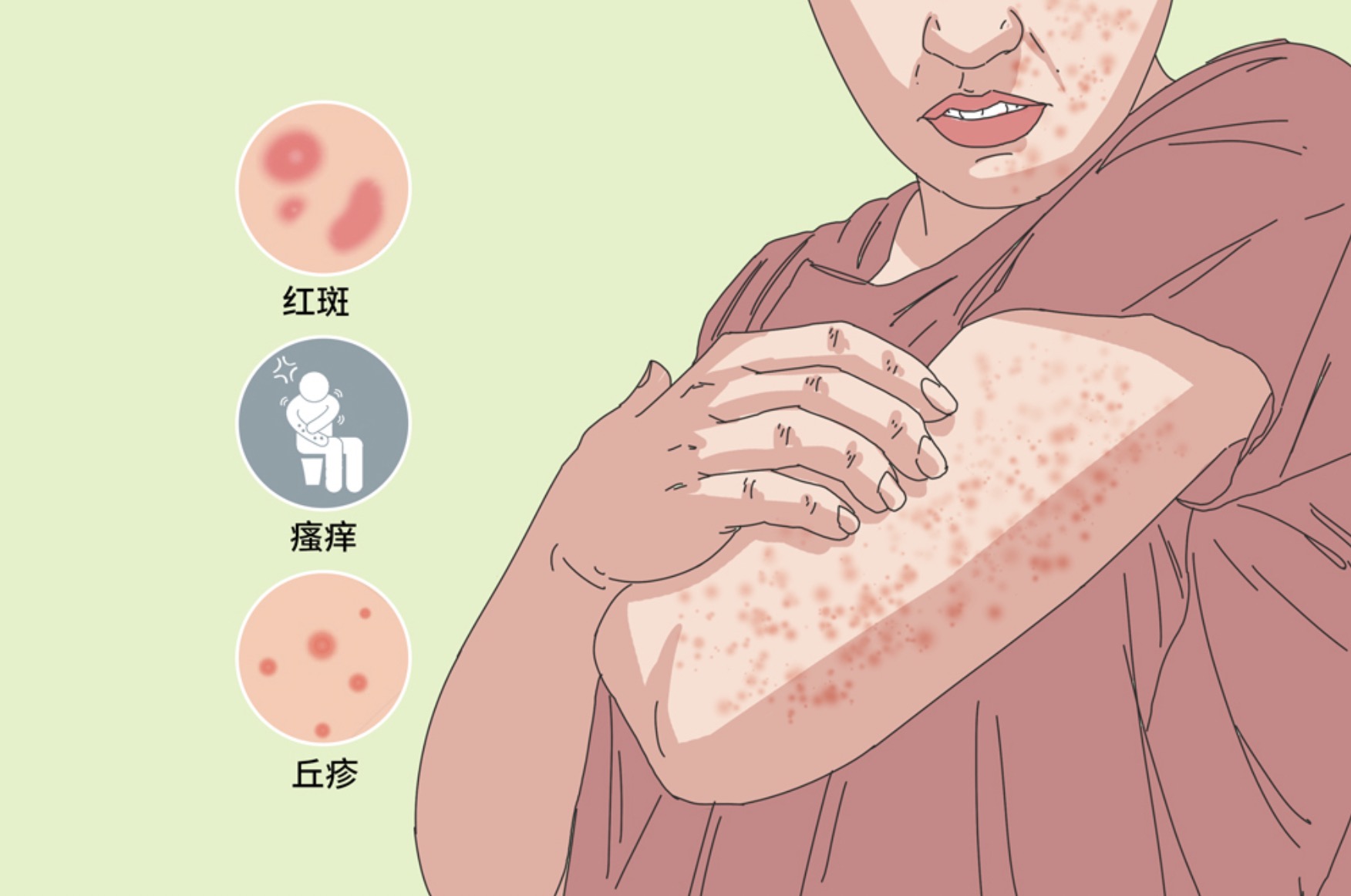 皮肤疾病，不仅要治疗，更要预防！